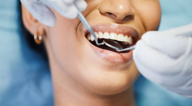 Best Same-Day Emergency Dentist in Mount Gilead, OH